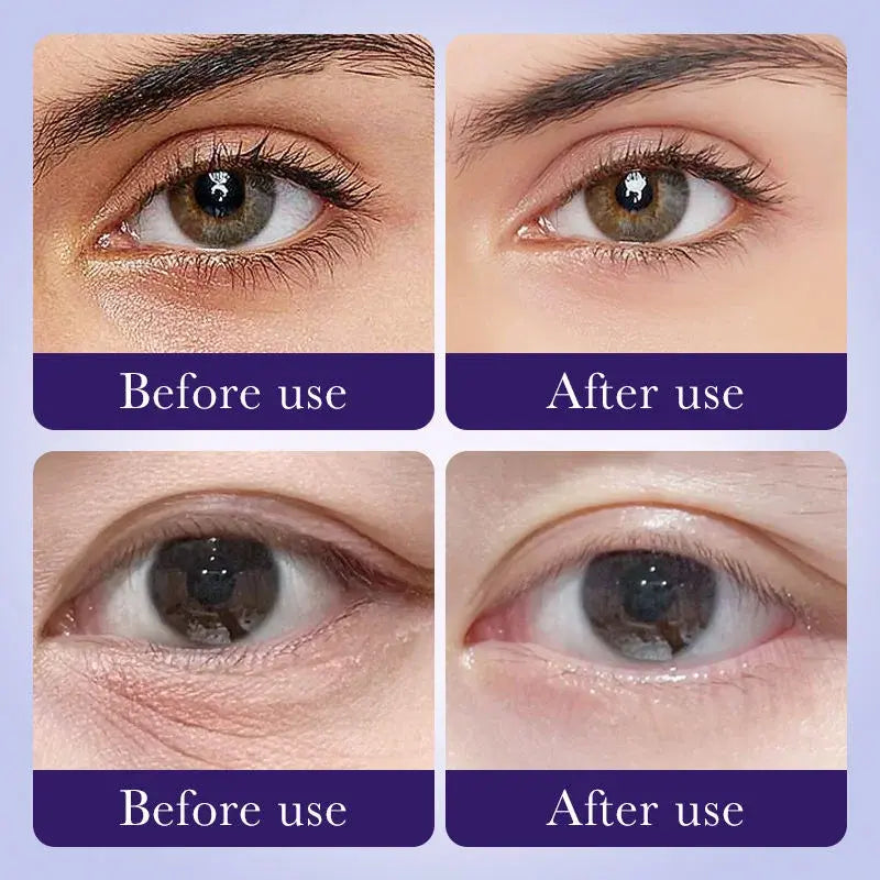 Parches Reafirmantes para Ojos con 60% de AHA + Antioxidantes (60 piezas)
